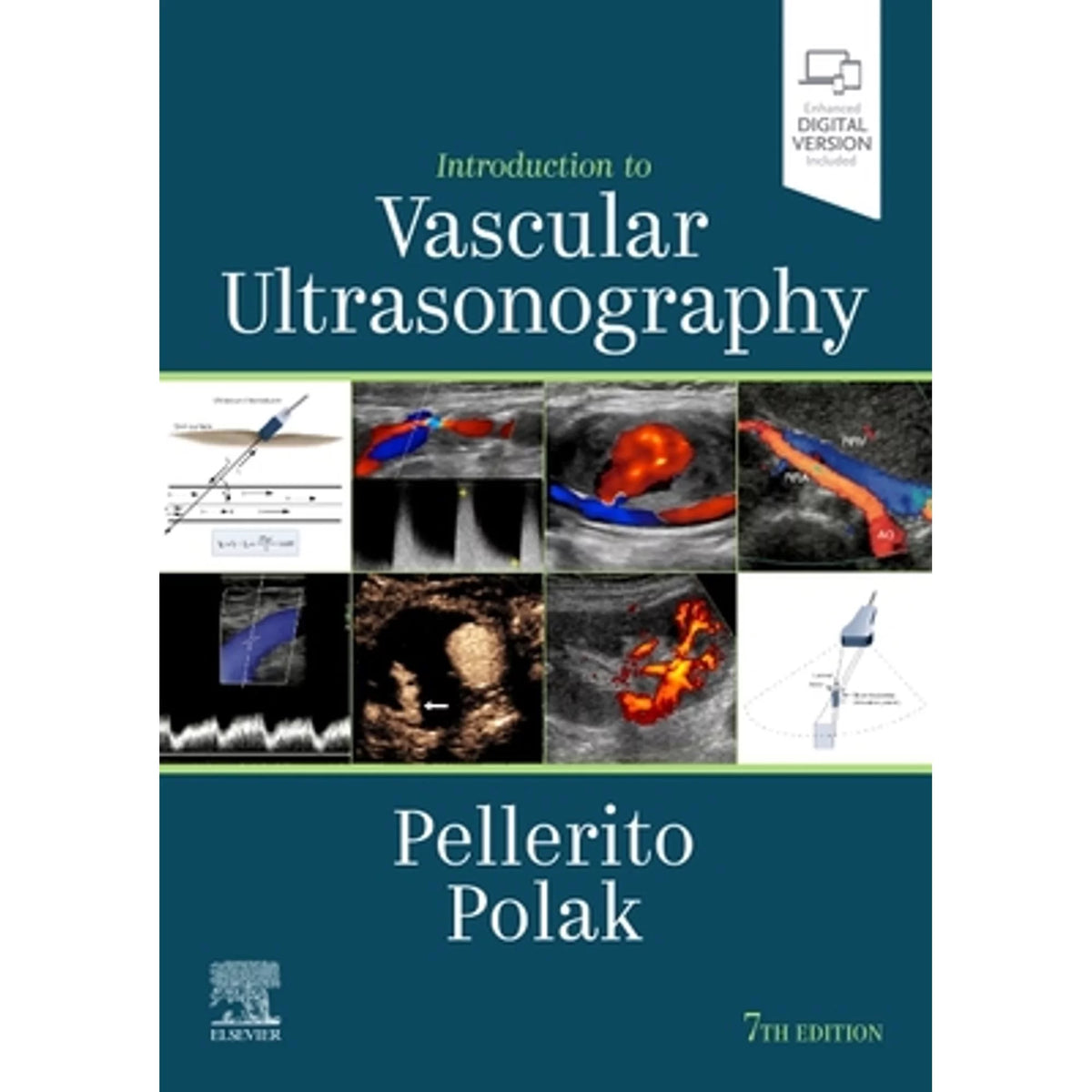 Introduction to Vascular Ultrasonography Hardcover H76286
